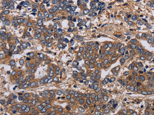 HTR2B Polyclonal Antibody Store at -20°C