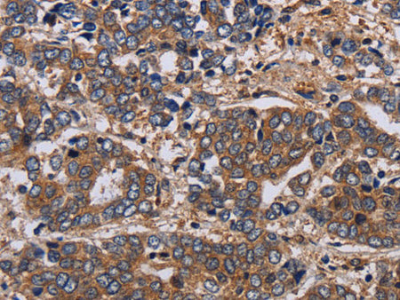 HTR2B Polyclonal Antibody Store at -20°C