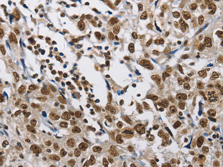 CMTM2 Polyclonal Antibody Store at -20°C