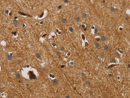IL18R1 Polyclonal Antibody Store at -20°C