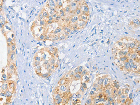 BRCA1 Polyclonal Antibody Store at -20°C