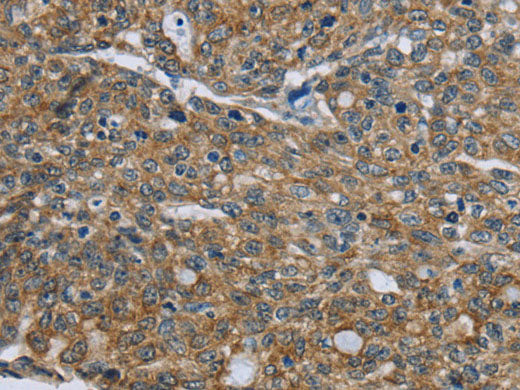 CK-5 Polyclonal Antibody