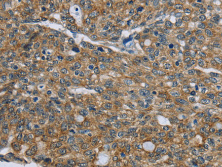 CK-5 Polyclonal Antibody
