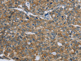 CK-5 Polyclonal Antibody