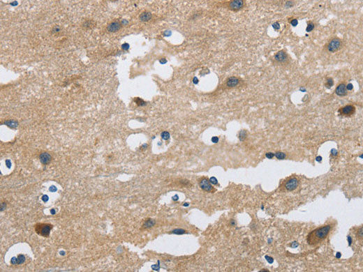 FGF9 Polyclonal Antibody Store at -20°C