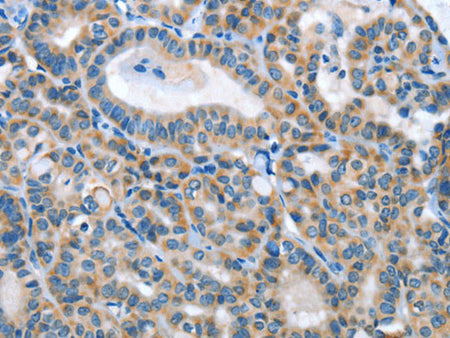 ANGPT2 Polyclonal Antibody Store at -20°C