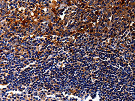 IL10RA Polyclonal Antibody Store at -20°C