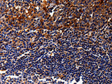 IL10RA Polyclonal Antibody Store at -20°C