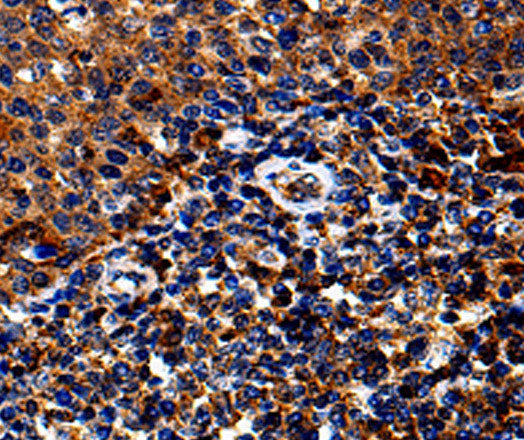 IL13RA1 Polyclonal Antibody Store at -20°C