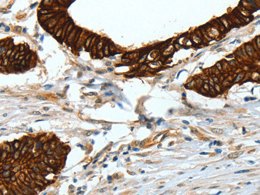 CK-18 Polyclonal Antibody Store at -20°C