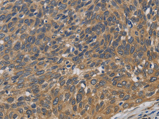 EMC8 Polyclonal Antibody Store at -20°C