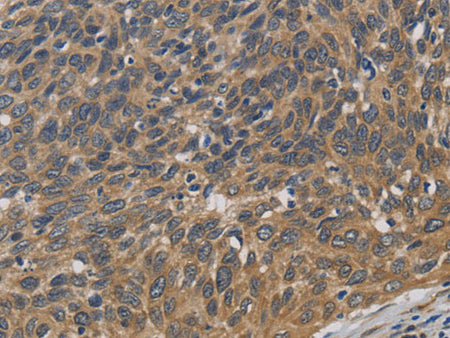 EMC8 Polyclonal Antibody Store at -20°C