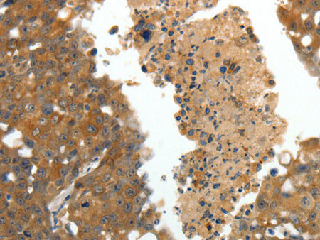 CRP Polyclonal Antibody Store at -20°C