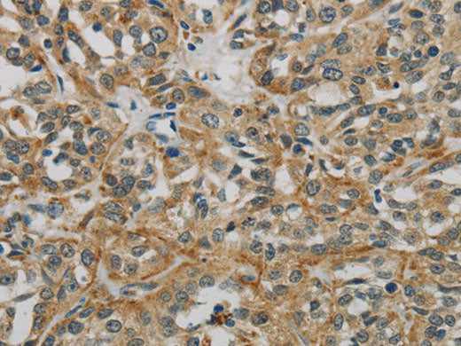 E2F6 Polyclonal Antibody