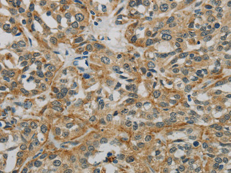 E2F6 Polyclonal Antibody