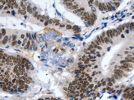LRP5 Polyclonal Antibody Store at -20°C