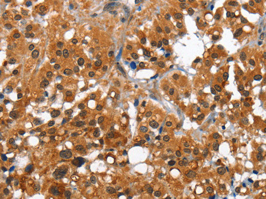 CAMK1D Polyclonal Antibody Store at -20°C