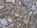 DAN Polyclonal Antibody