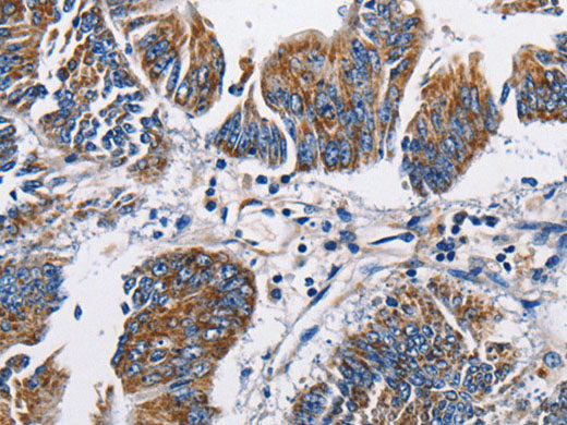 SPHK2 Polyclonal Antibody Store at -20°C