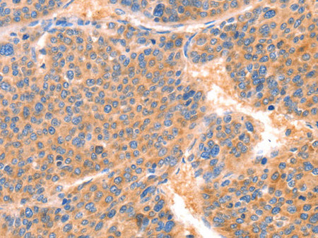 PRDX2 Polyclonal Antibody Store at -20°C