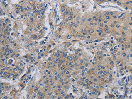 DNAJB4 Polyclonal Antibody Store at -20°C