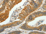 SH-PTP1 Polyclonal Antibody