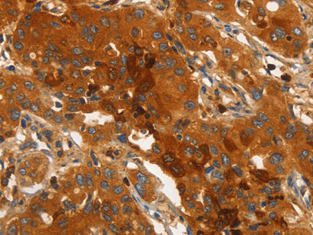 ORM2 Polyclonal Antibody Store at -20°C
