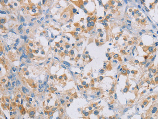 CERKL Polyclonal Antibody Store at -20°C