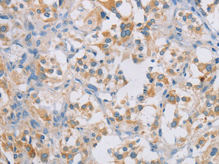 CERKL Polyclonal Antibody Store at -20°C