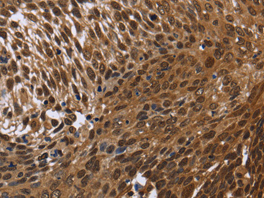 DCP1A Polyclonal Antibody Store at -20°C