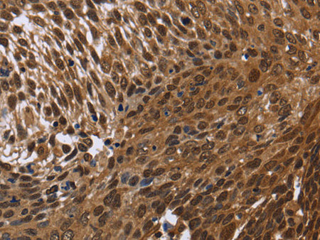 DCP1A Polyclonal Antibody Store at -20°C