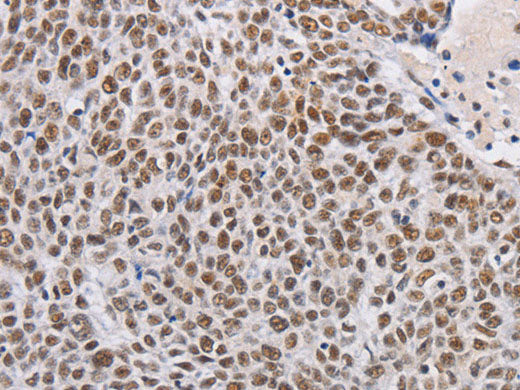 THOC7 Polyclonal Antibody Store at -20°C