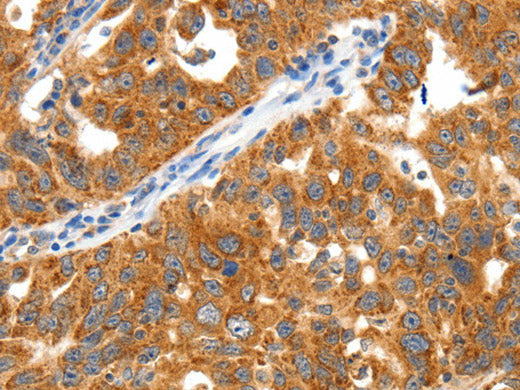 TRAF3 Polyclonal Antibody Store at -20°C
