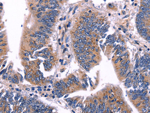 ARC Polyclonal Antibody Store at -20°C