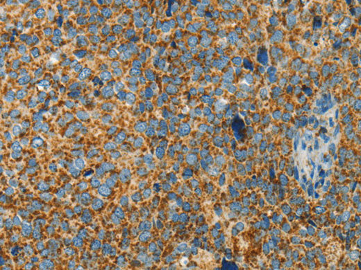 BCAT2 Polyclonal Antibody Store at -20°C