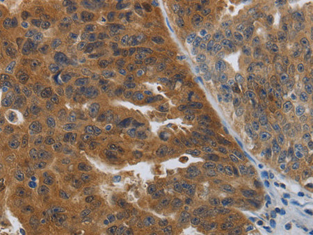 PDCD2 Polyclonal Antibody Store at -20°C