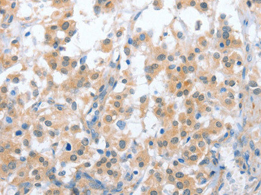 OX2R Polyclonal Antibody Store at -20°C
