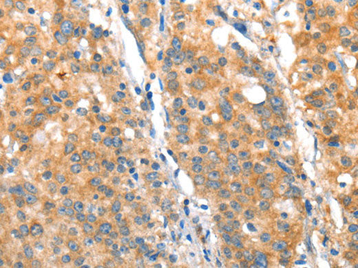 ST14 Polyclonal Antibody Store at -20°C