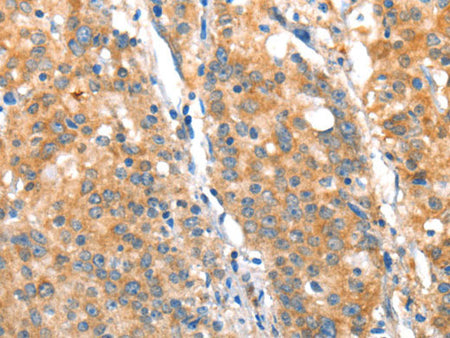 ST14 Polyclonal Antibody Store at -20°C