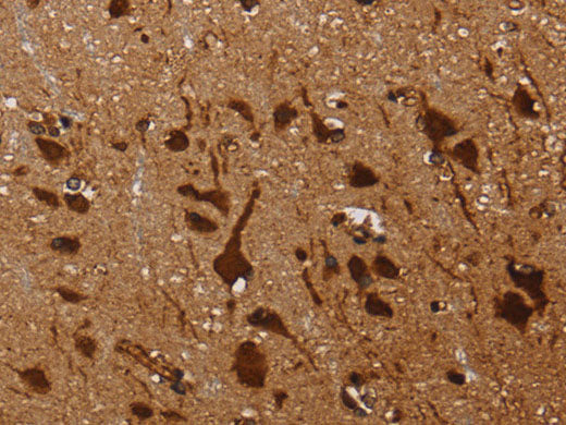 KARS Polyclonal Antibody Store at -20°C