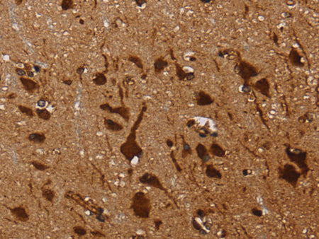 KARS Polyclonal Antibody Store at -20°C