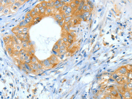 ASNS Polyclonal Antibody Store at -20°C