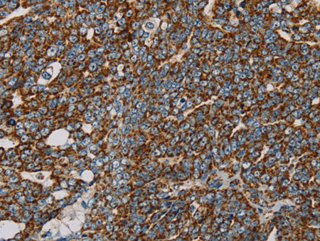NDUFS3 Polyclonal Antibody Store at -20°C