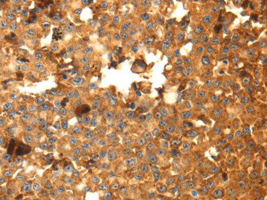 DRD5 Polyclonal Antibody Store at -20°C