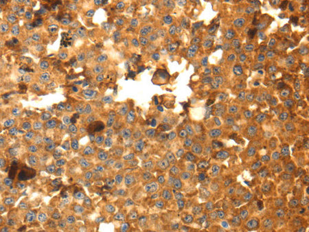 DRD5 Polyclonal Antibody Store at -20°C