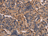 MAP1LC3C Polyclonal Antibody