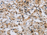 KPNB1 Polyclonal Antibody