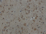 AKT1 Polyclonal Antibody Host Rabbit