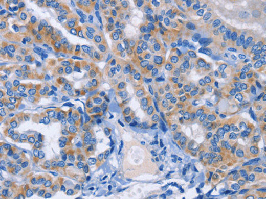 AMACR Polyclonal Antibody Store at -20°C