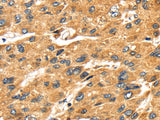 SH3KBP1 Polyclonal Antibody Store at -20°C